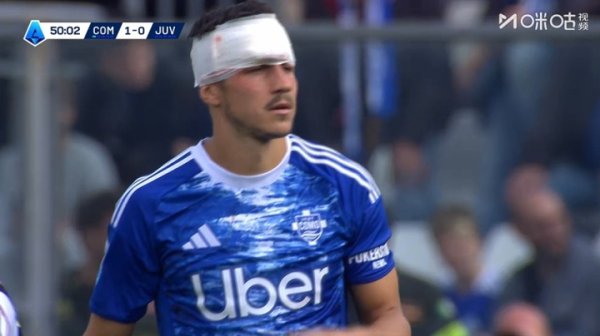 巨流冲了龙王庙😶肯普夫与队友相撞背面部血流不啻，接管包扎